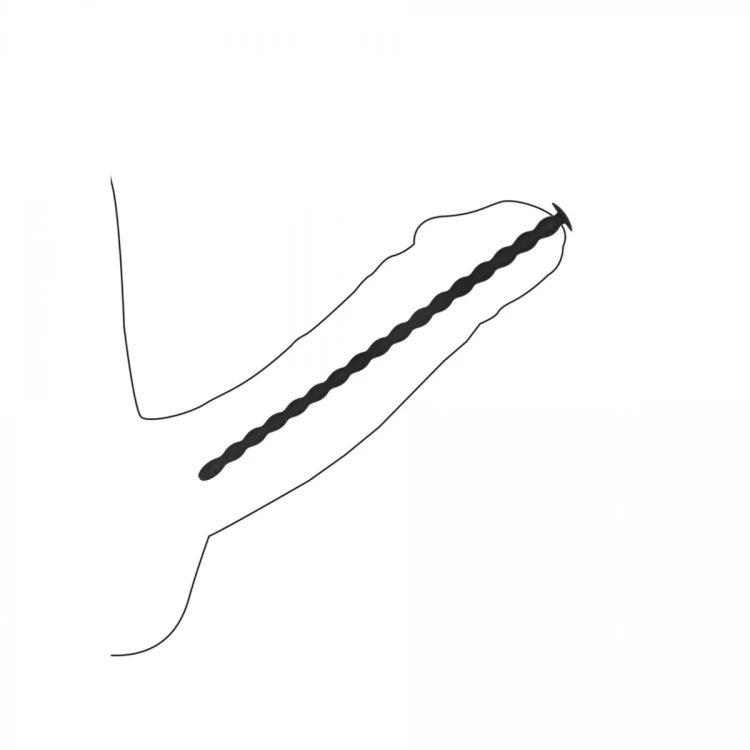 Silicone Spiral Screw Plug Set Advanced